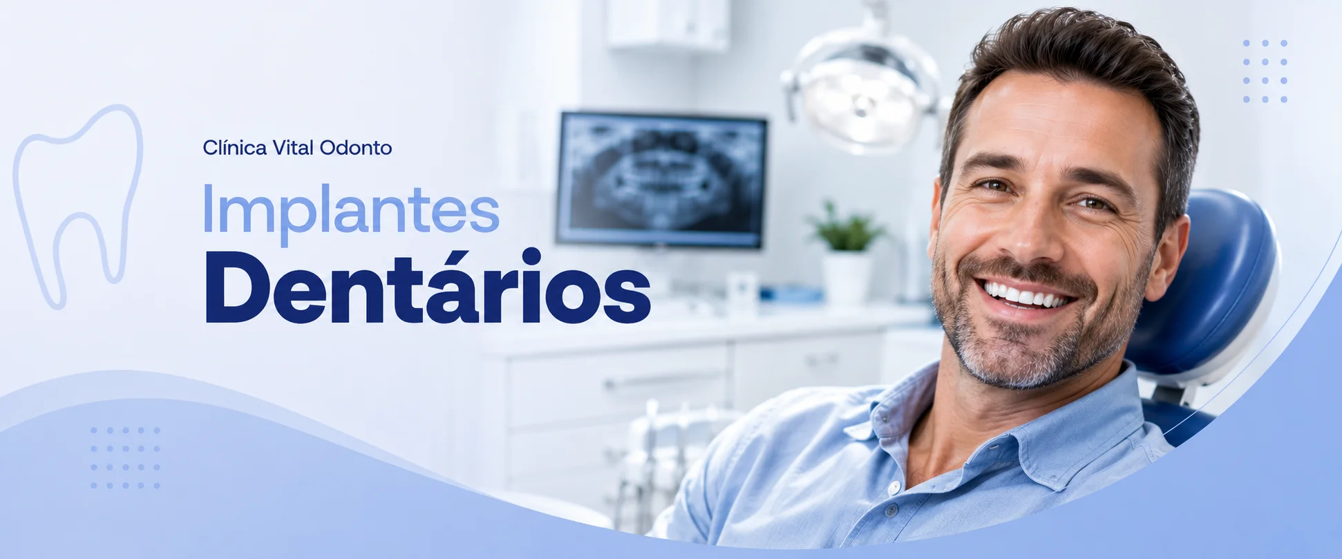 Implantes Dentários